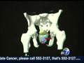 News video: New therapy for prostate cancer
